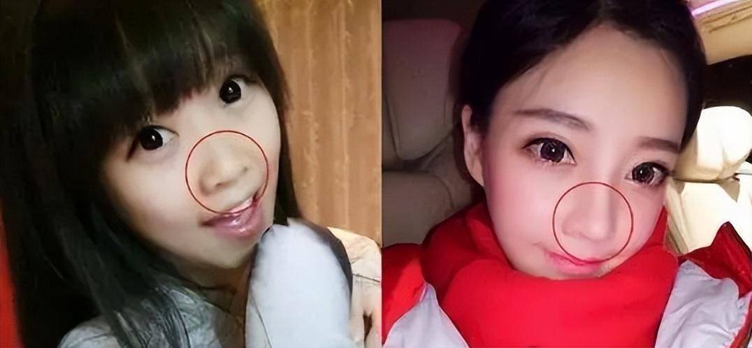 鞠婧祎四千年美人整容真相_女明星整容吗_娱乐圈整容明星
