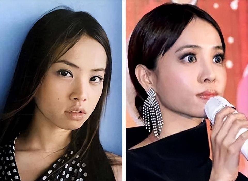 鞠婧祎四千年美人整容真相_女明星整容吗_娱乐圈整容明星