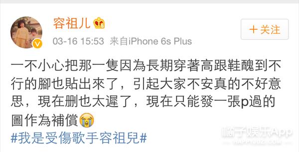 贝嫂拇指外翻手术_女明星的脚趾头最美_容祖儿拇指外翻