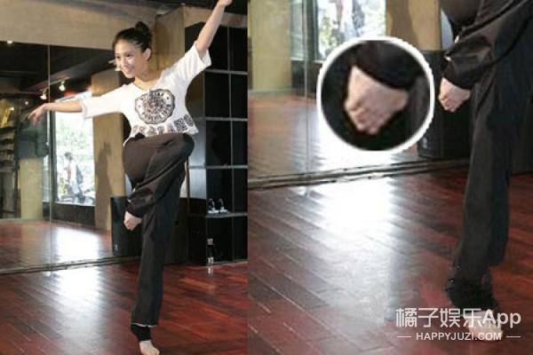 女明星的脚趾头最美_容祖儿拇指外翻_贝嫂拇指外翻手术