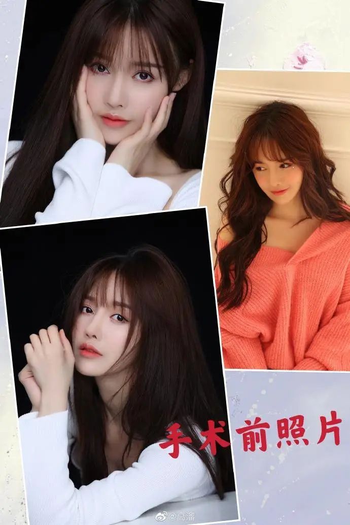 医美事故受害者高溜_整容失败的女明星中国_演员高溜整容失败鼻头坏死维权