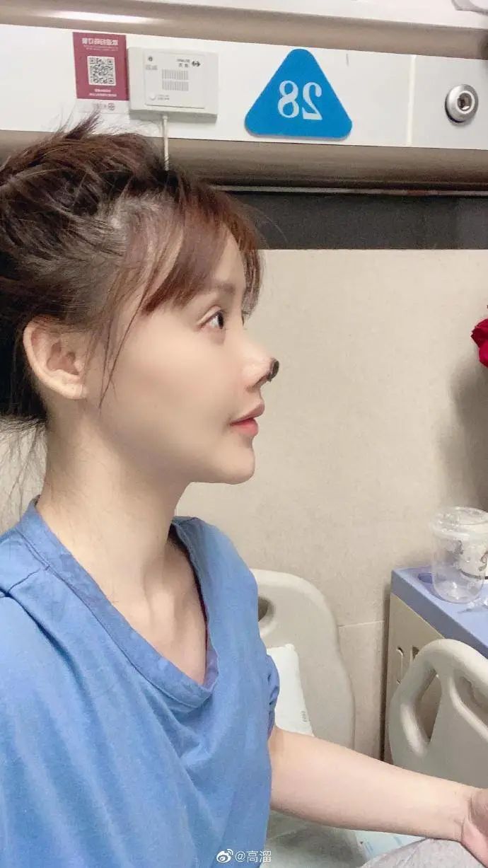 整容失败的女明星中国_医美事故受害者高溜_演员高溜整容失败鼻头坏死维权