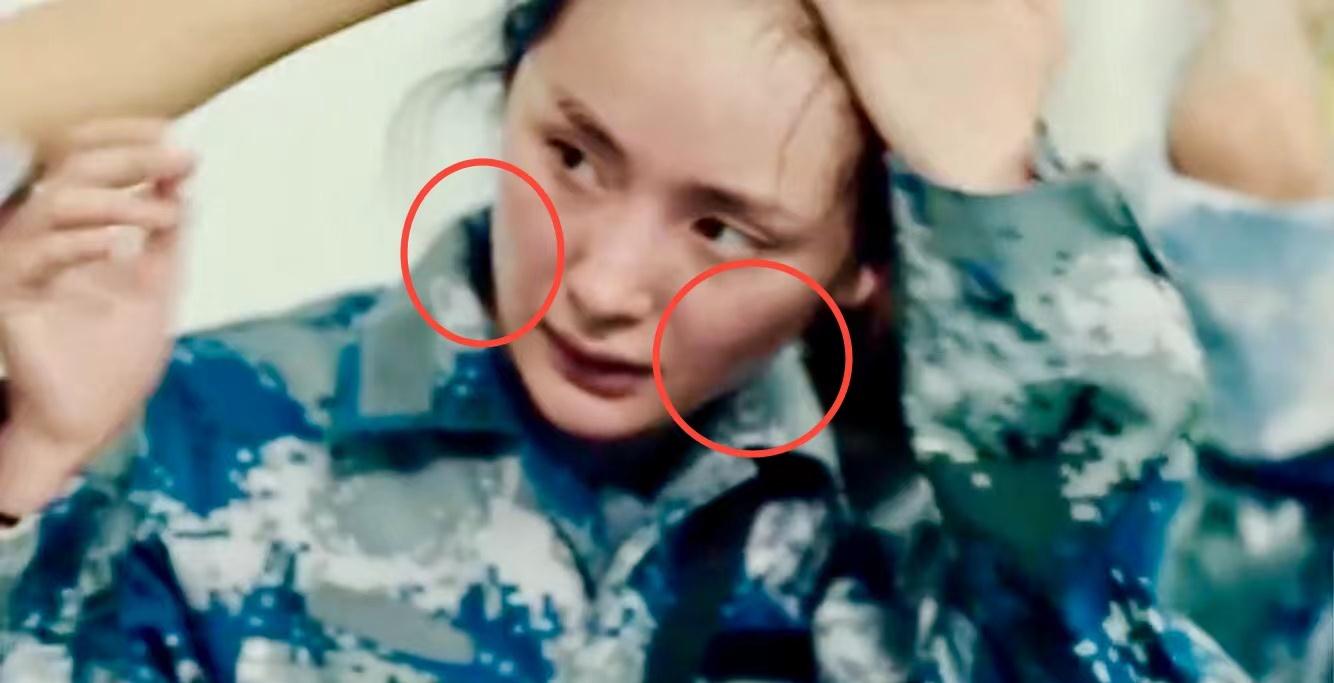 明星病痛_女明星生理缺陷_冯小刚白斑