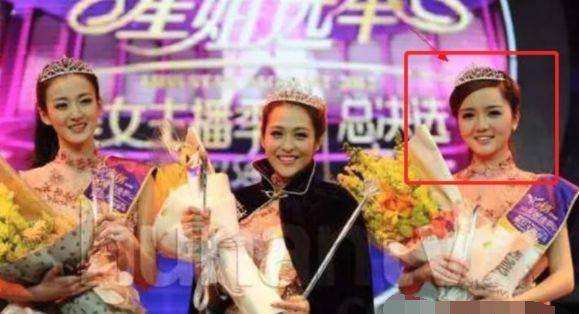 娱乐圈整容美女_混血女明星鼻子_美女整容前后对比